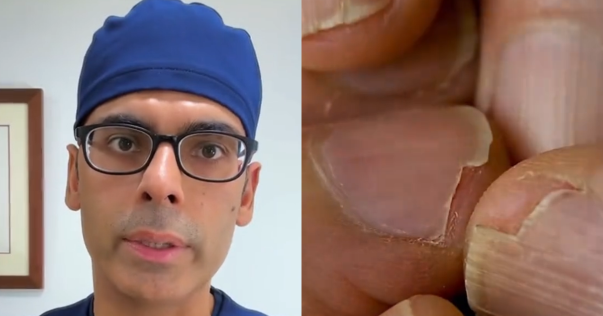 Doctor Shares 5 Signs Your Body May Be Lacking Essential Nutrients
