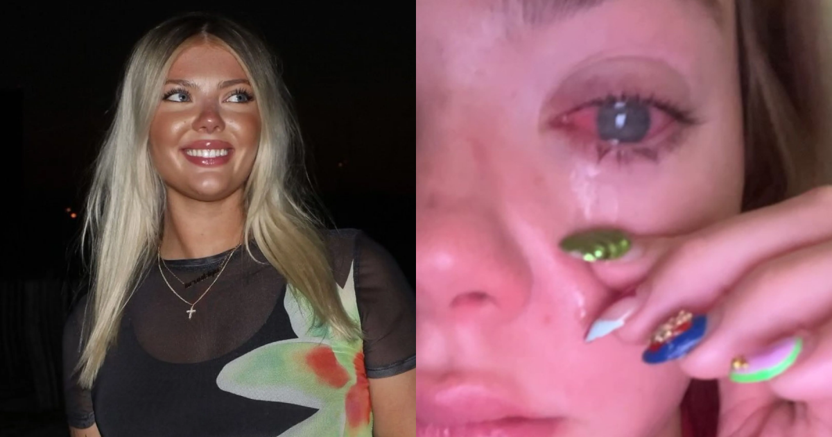 Woman Thinks She Has Sand In Her Eye, Later Discovers The Horrific Cause Of Her Vision Loss