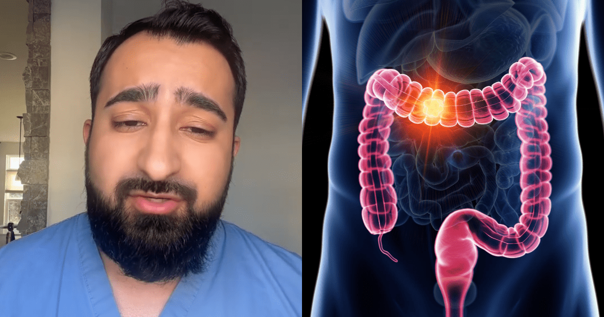 Doctor Explains 5 Concerning Symptoms That Could Signal Colon Cancer