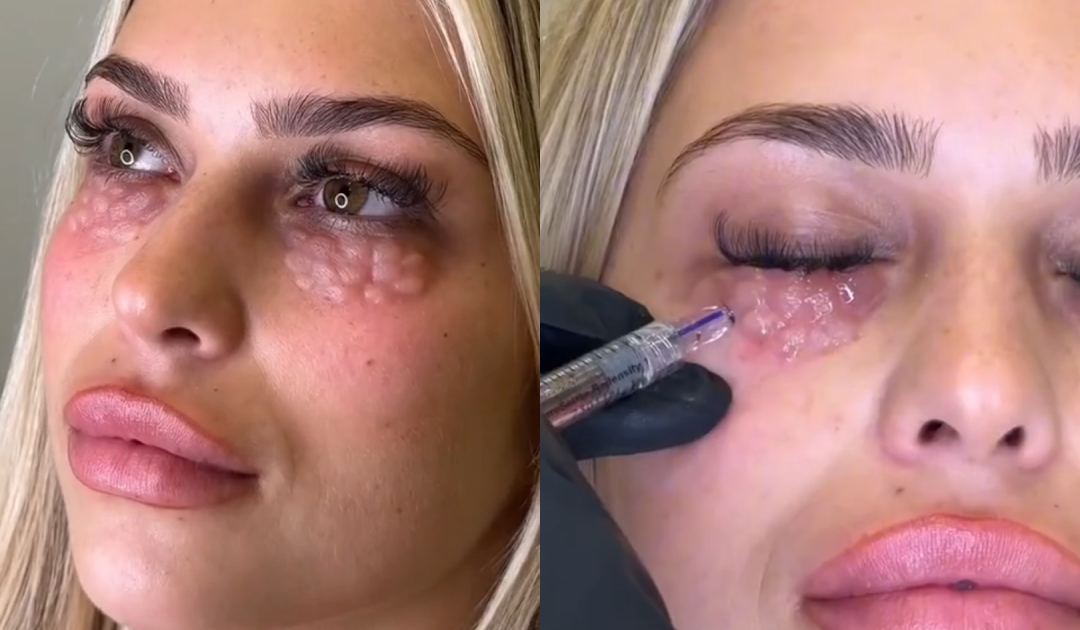 Doctors Warn About Permanent Damage From Beauty Trend That Leaves Skin Looking ‘Reptilian’