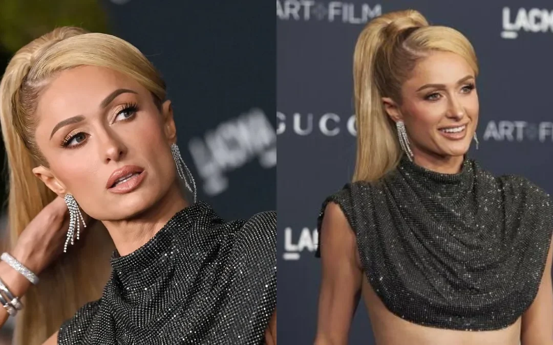 Paris Hilton Feels Proud For Being ‘All Natural’, Shares Her Thoughts On Plastic Surgery, Botox