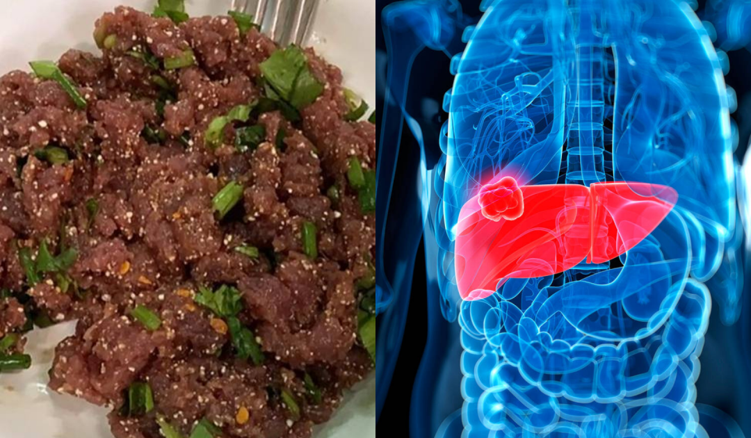 Deadly Thai Dish Linked To Cancer Risks Millions Still Ignore
