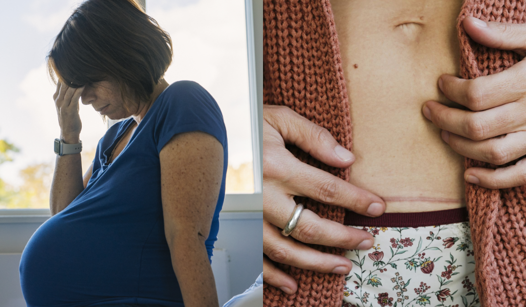 Woman Performed Her Own C-Section With A Kitchen Knife And No Medical Training