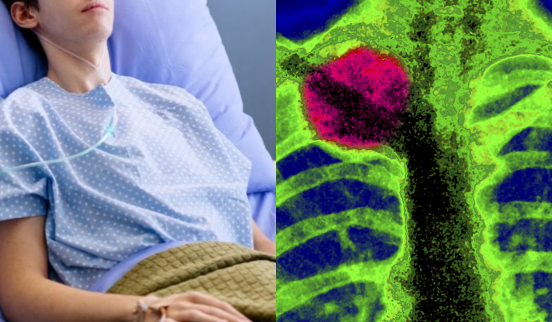 Teen Boy Initially Told He Pulled A Muscle, Later Diagnosed With Rare Terminal Cancer