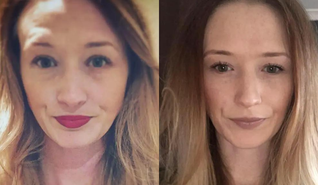 Woman, 29, Dies After Chiropractor ‘Cracked Her Neck’ During Treatment